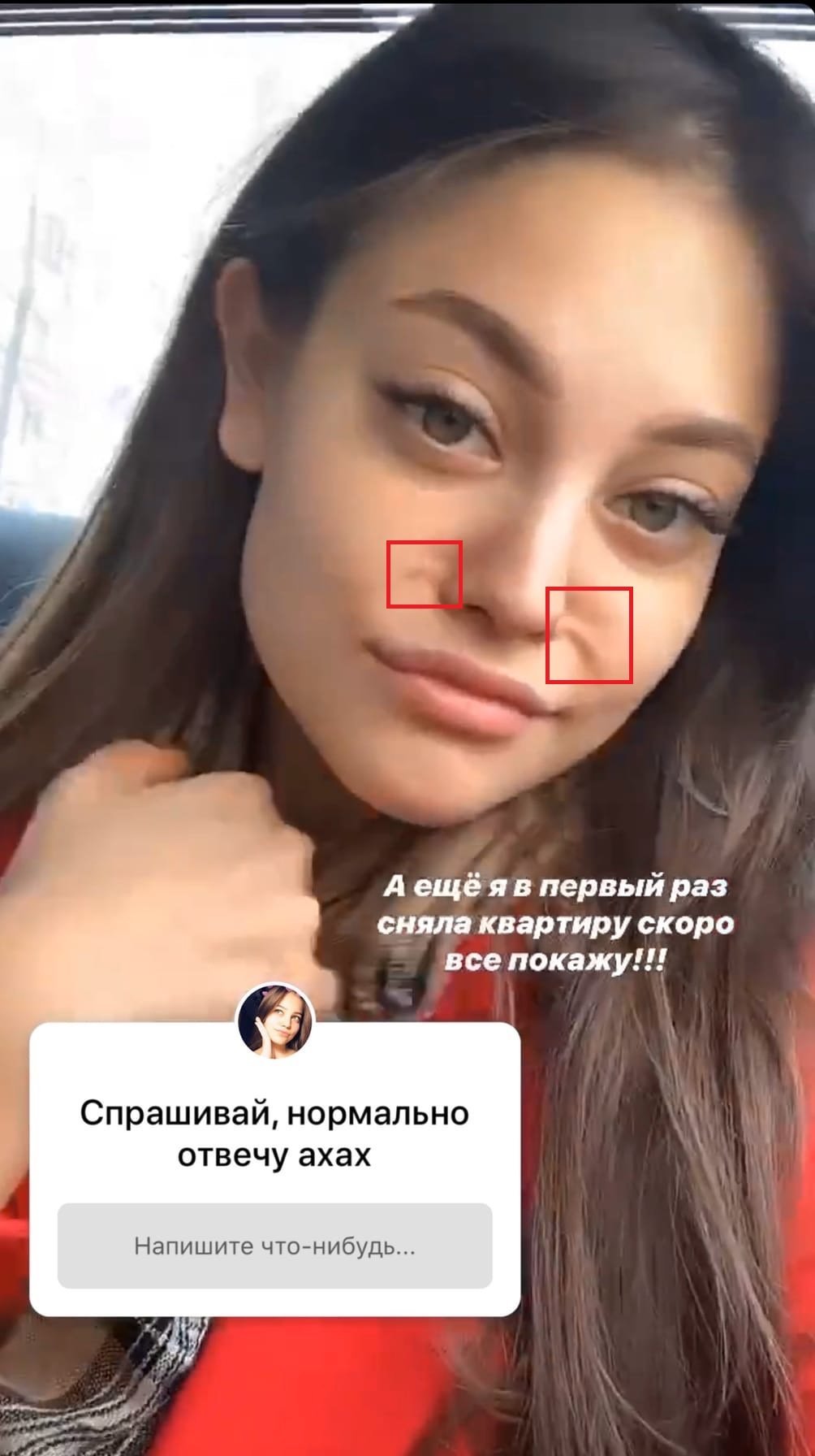 Девушка МОРГЕНШТЕРНА