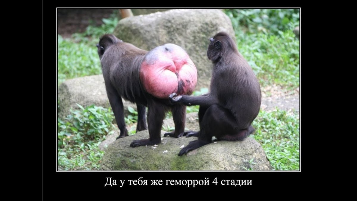Демотиваторы про зад