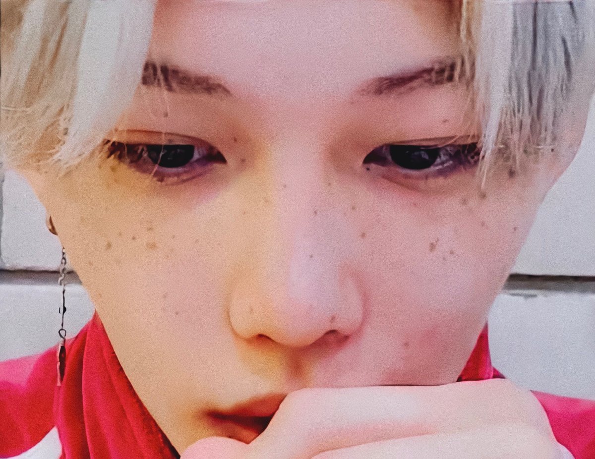 Felix Lee веснушки